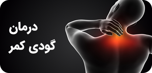 درمان گودی کمر