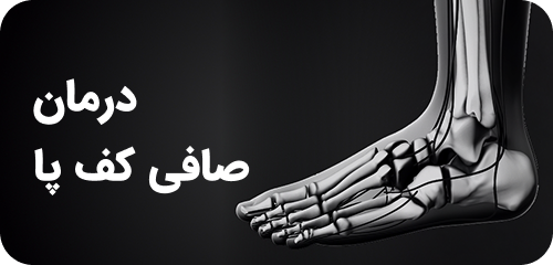 درمان صافی کف پا