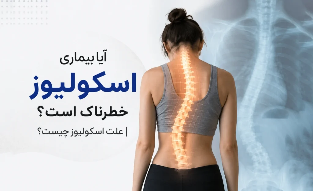 آیا بیماری اسکولیوز خطرناک است؟ | علت اسکولیوز چیست؟