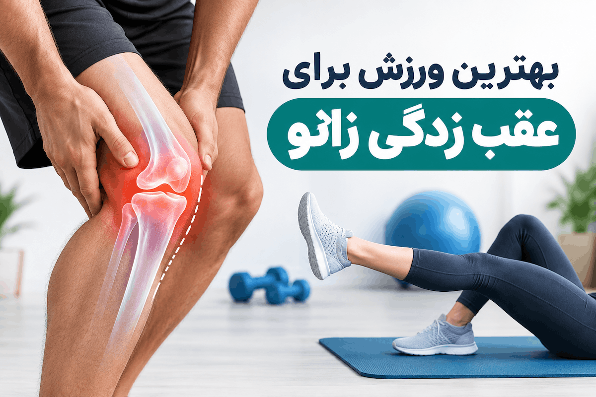 بهترین ورزش برای عقب زدگی زانو