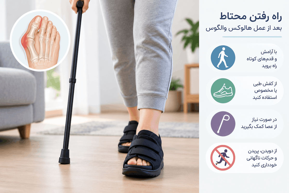 راه رفتن بعد از عمل هالوکس والگوس