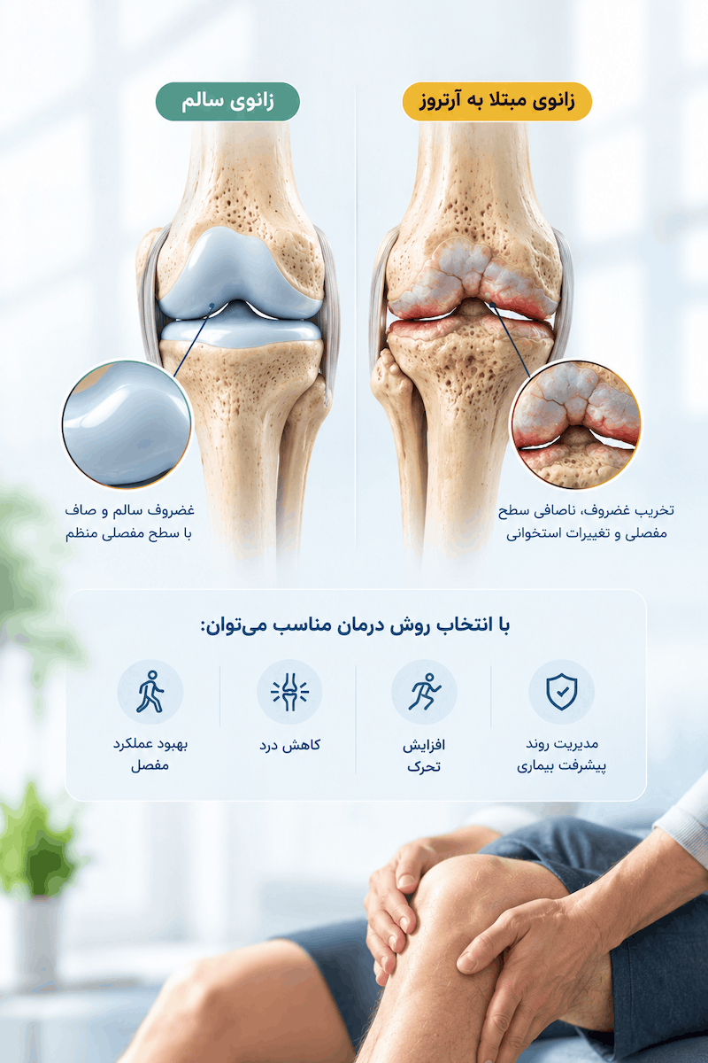آیا آرتروز زانو قابل درمان است؟